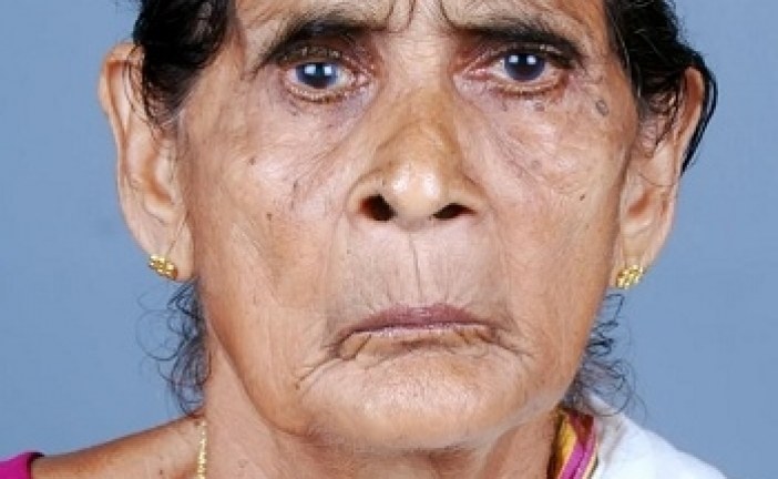 കടമ്പോട് മേക്കാടൻ വീട്ടിൽ വിലാസിനി (90) അന്തരിച്ചു
